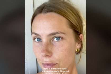 The 28 Year Old Mother Posted Her ``real Face'' To Normalize Aging,