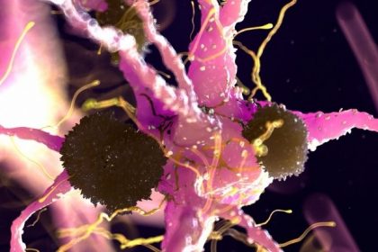 Parkinson's Disease Discovery Suggests Fda Approved Treatment May Already Exist: Sciencealert